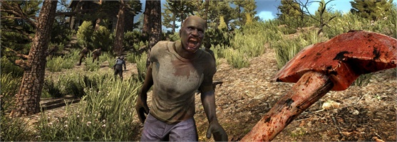 7 Days to Die Artık Konsolda Oyun Haberi 7 Days to Die Artık Konsolda Oyun Haberi
